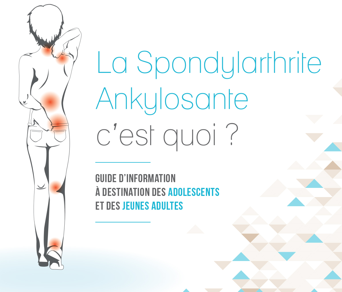 Rhumatologie spondylarthrite Ankylosante